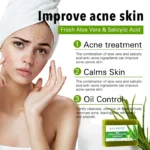 AILKE Aloe Vera Whitening Soap, Remove Acne, Pimples - Image 3