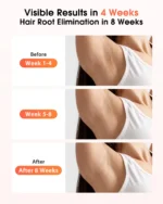 IPL Devices Hair Removal Laser 17J 999900 Light Pulses - Image 3