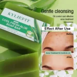 AILKE Aloe Vera Whitening Soap, Remove Acne, Pimples - Image 6