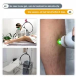 2026 SLyriclaser 1064/532nm long pulse width High quality 1064nm painless hair removal - Image 5